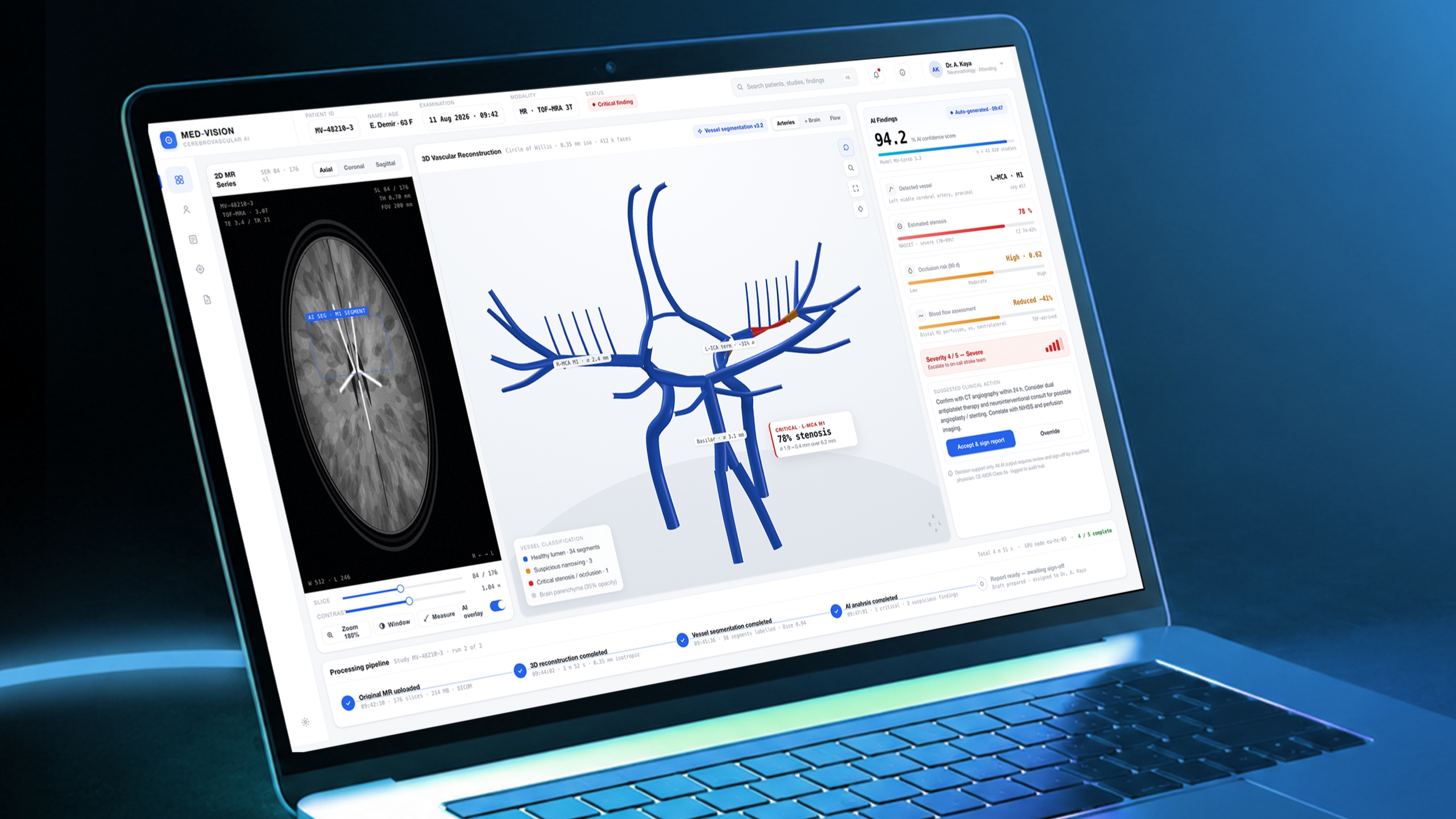 MED-VISION clinical decision support mockup